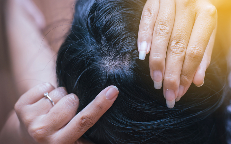 علت درد ریشه مو و پوست سر چیست؟