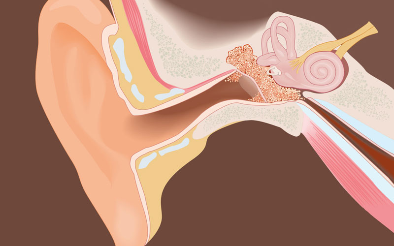 ساختار گوش داخلی